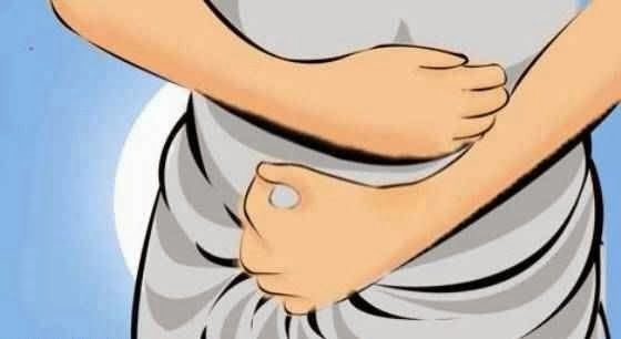 أسباب ألم التبويض يشبه ألم الدورة