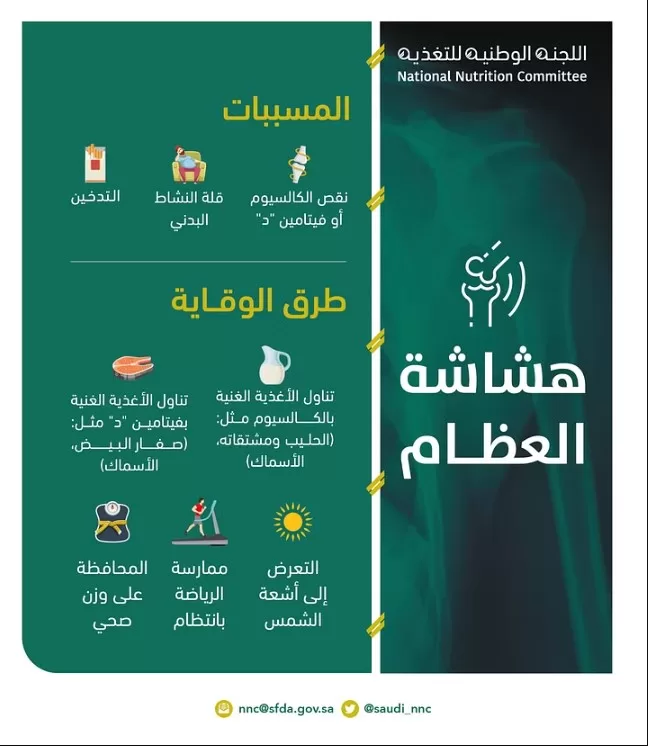 اللجنة الوطنية للتغذية: التدخين وإهمال النشاط البدني أهم أسباب هشاشة العظام