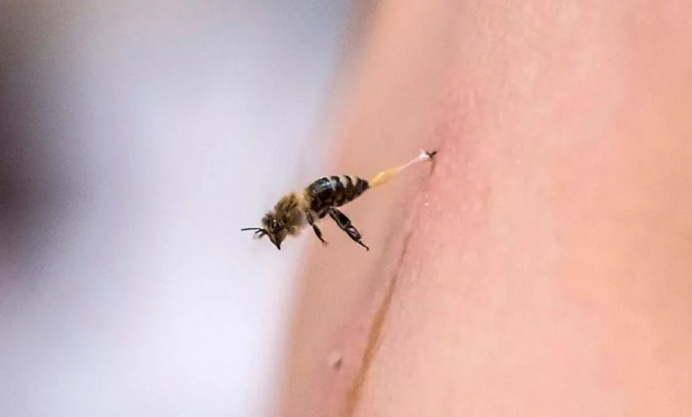 الصحة تحذّر من التداوي بِسُمّ النحل.. لا توجد براهين علمية
