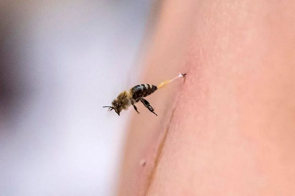 الصحة تحذّر من التداوي بِسُمّ النحل.. لا توجد براهين علمية