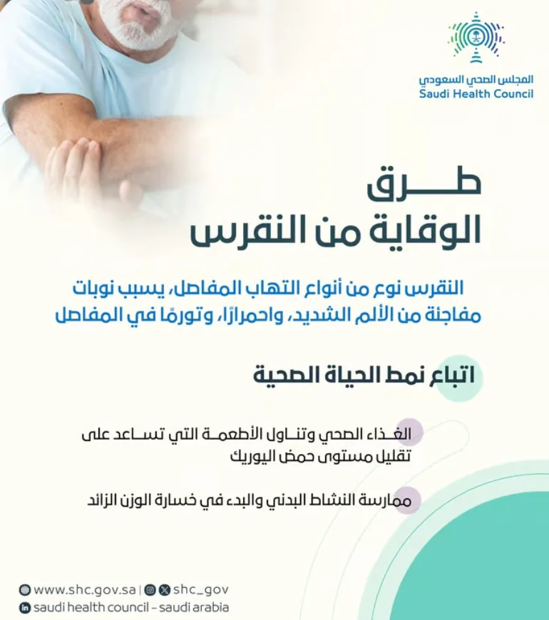 نوبات مفاجئة من الألم.. "النقرس وطرق الوقاية منه" في إيضاح لـ"الصحي السعودي"