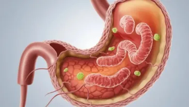 الثوم على رأس القائمة.. 8 أطعمة تساعد في علاج جرثومة المعدة