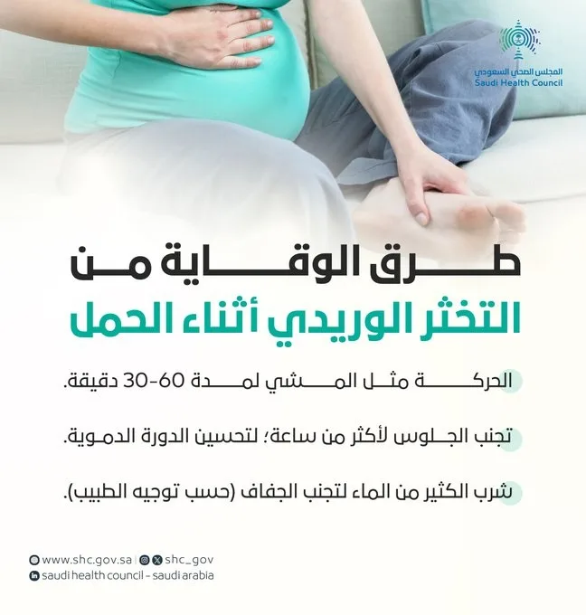 المجلس الصحي: 3 طرق للوقاية من التخثر الوريدي أثناء الحمل